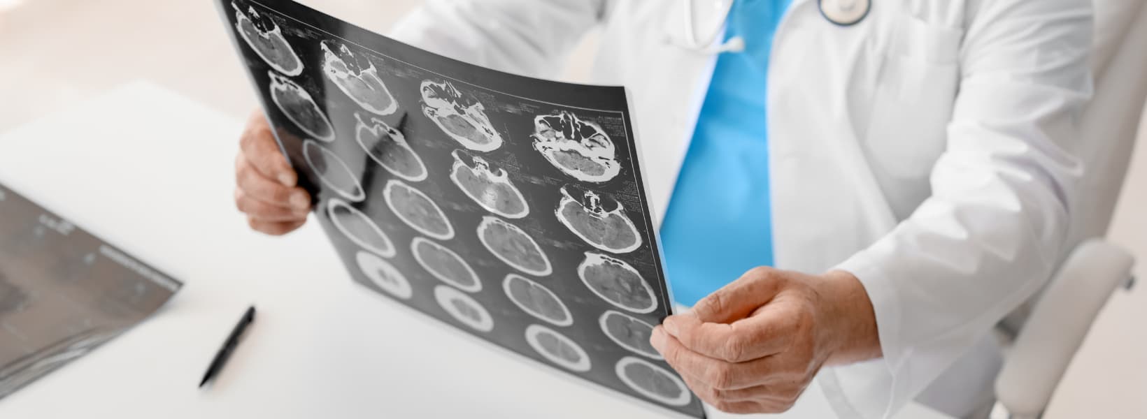 From tragedy to triumph: rehabilitation for survivors of brain injury